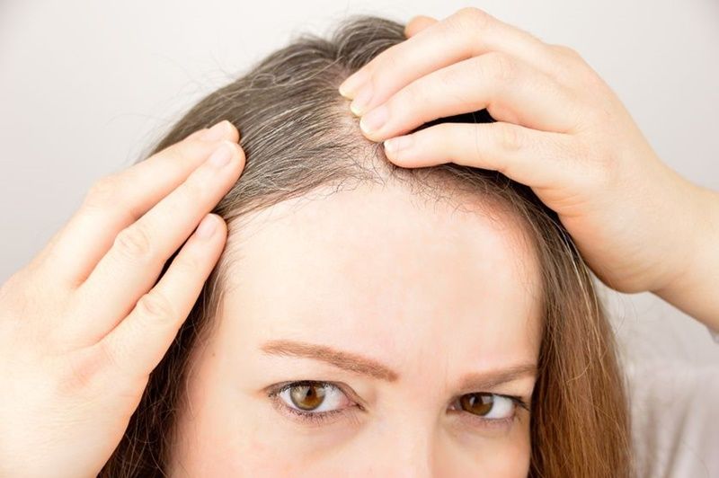 Por qué salen canas prematuras y cómo evitarlas