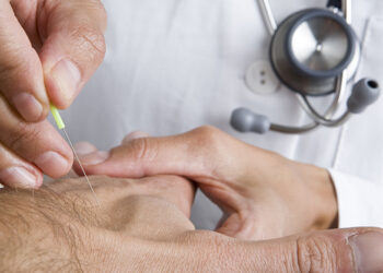 acupuntura y cancer