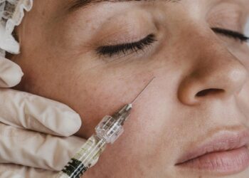 5 cosas que debe saber sobre los bioestimuladores de colágeno