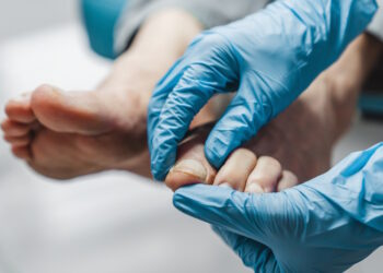 Todo sobre uñas dañadas: causas, tratamientos y cuándo acudir al médico